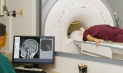 Магнитно-резонансная томография сосудов головного мозга: когда назначается, как проводится и сколько стоит?