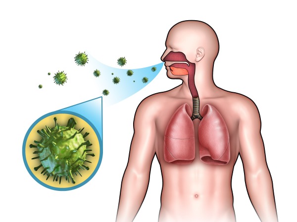 Схема заболевания пневмонией